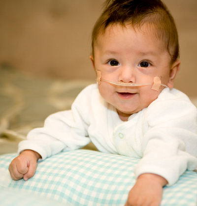 Baby wearing nasal cannula.