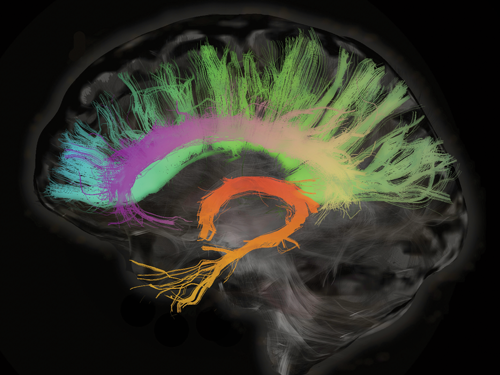 A conceptual illustration of a human brain