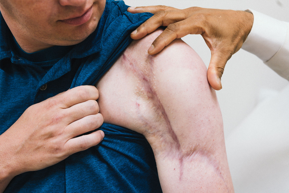 Leonard Preston's shoulder is covered in scars.