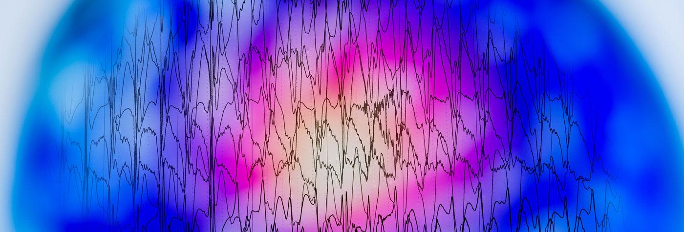 Stylized view of EEG readouts.