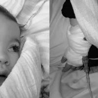Black and white photo collage. Close up of infant Izzy's face on one half, and a close up of an IV hooked up to an little Izzy's arm on the other half.